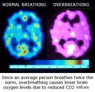 Brain oxygen levels for normal breathing and hyperventilation